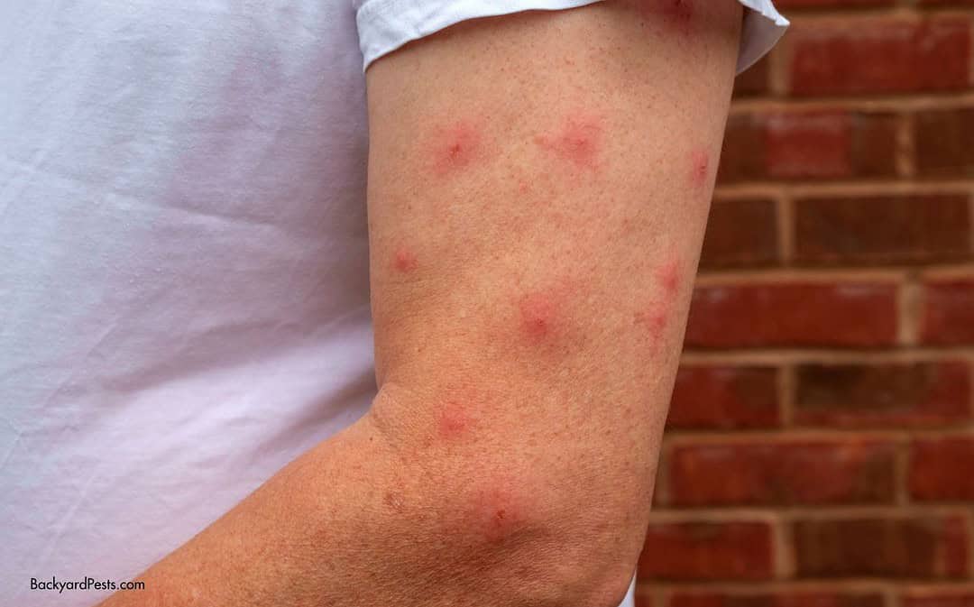 How Mosquitoes Choose Their Victims